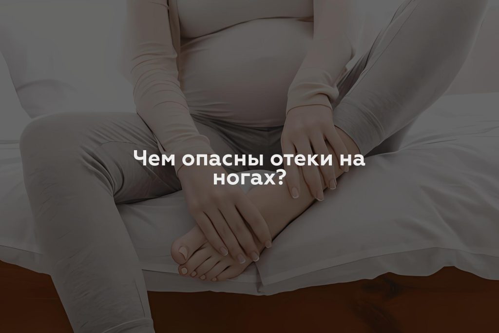 Чем опасны отеки на ногах?