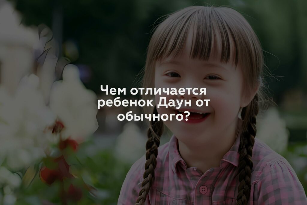 Чем отличается ребенок Даун от обычного?