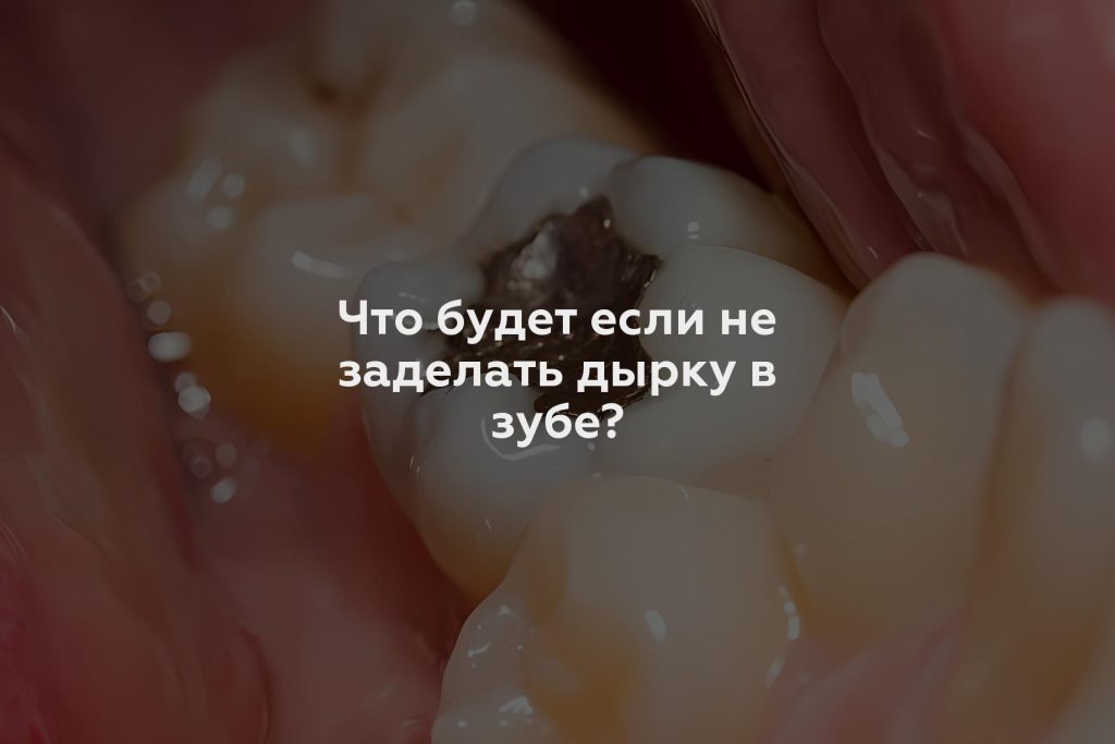 Что будет если не заделать дырку в зубе?