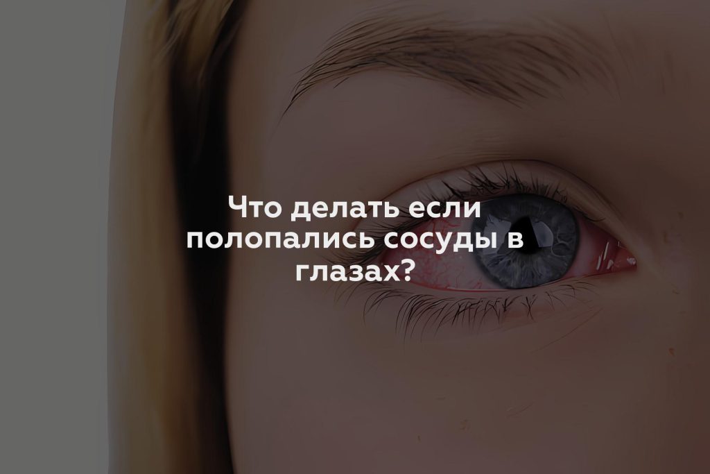 Что делать если полопались сосуды в глазах?