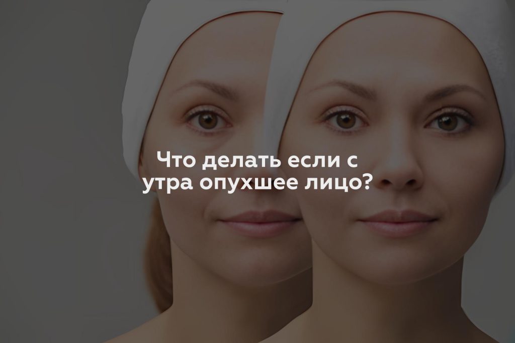 Что делать если с утра опухшее лицо?