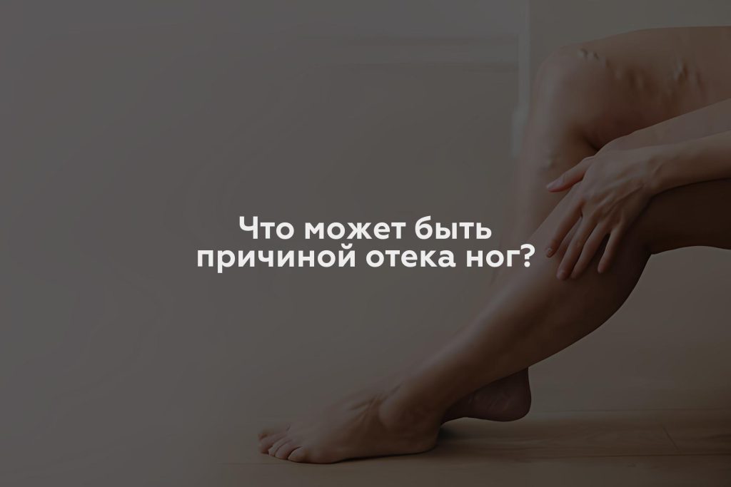 Что может быть причиной отека ног?