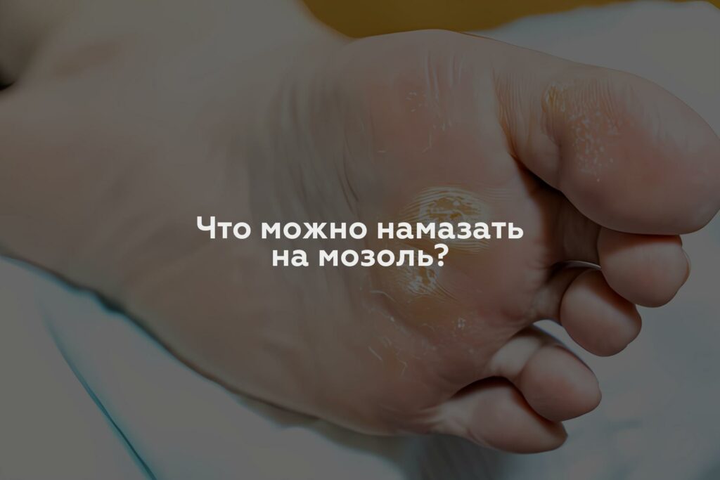 Что можно намазать на мозоль?