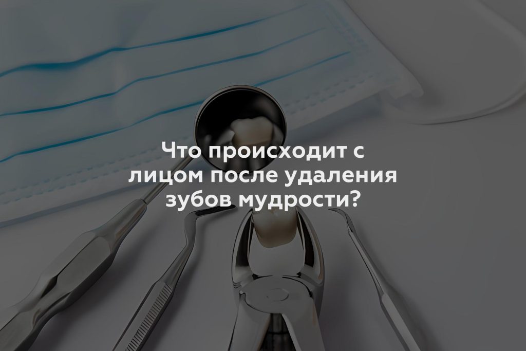 Что происходит с лицом после удаления зубов мудрости?