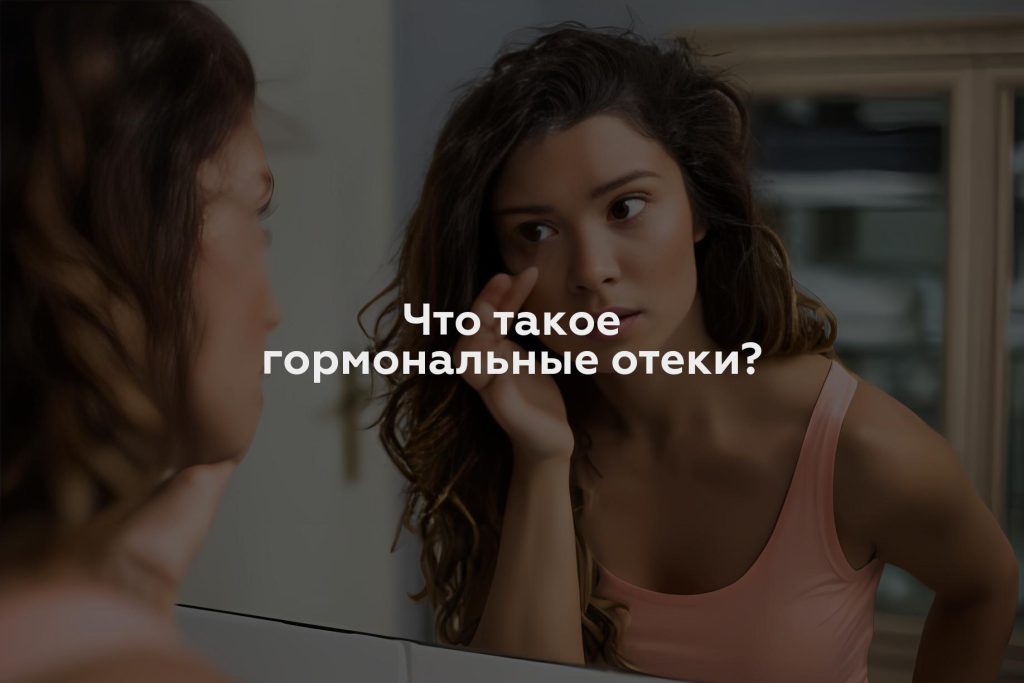 Что такое гормональные отеки?