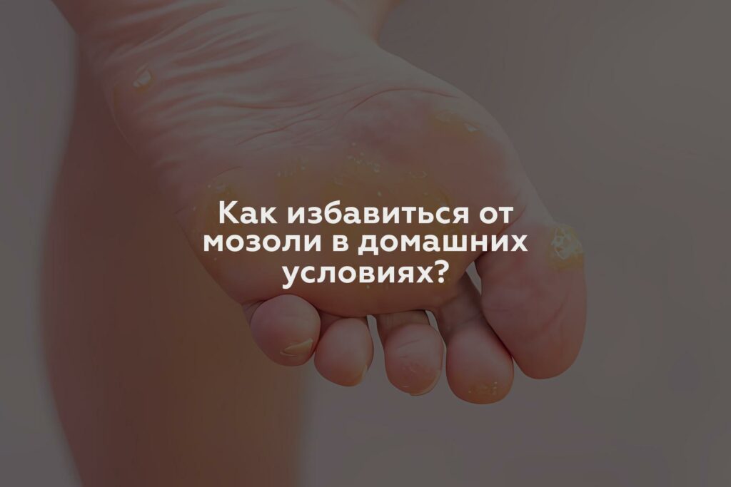 Как избавиться от мозоли в домашних условиях?