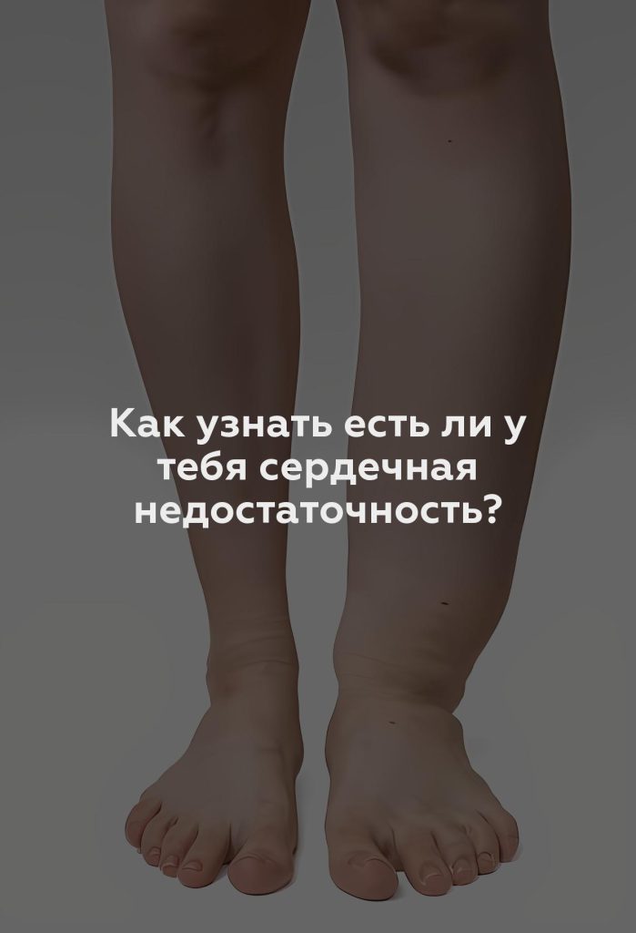 Как узнать есть ли у тебя сердечная недостаточность?