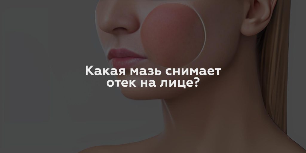 Какая мазь снимает отек на лице?