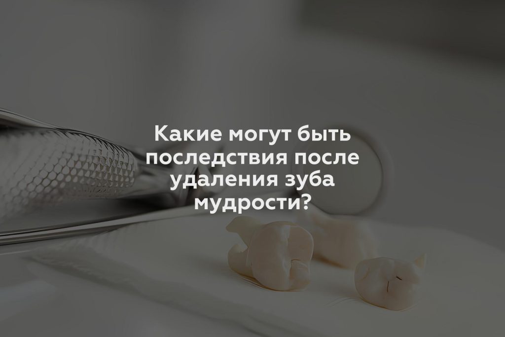 Какие могут быть последствия после удаления зуба мудрости?