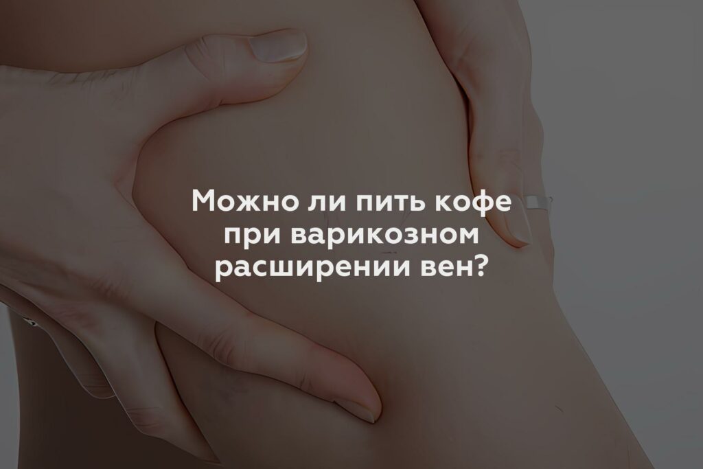 Можно ли пить кофе при варикозном расширении вен?