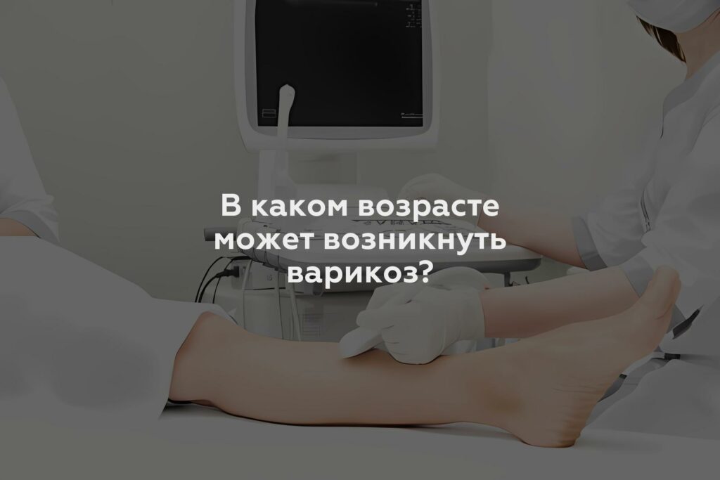 В каком возрасте может возникнуть варикоз?