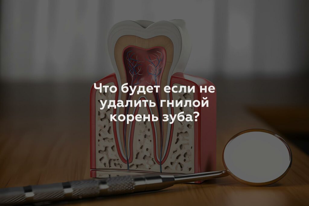 Что будет если не удалить гнилой корень зуба?