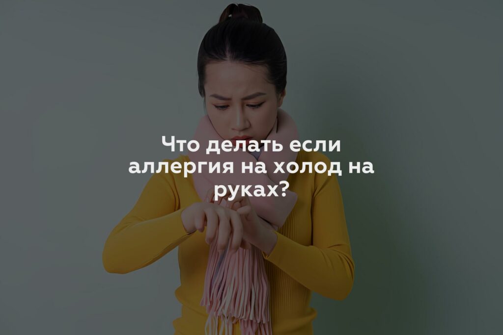 Что делать если аллергия на холод на руках?