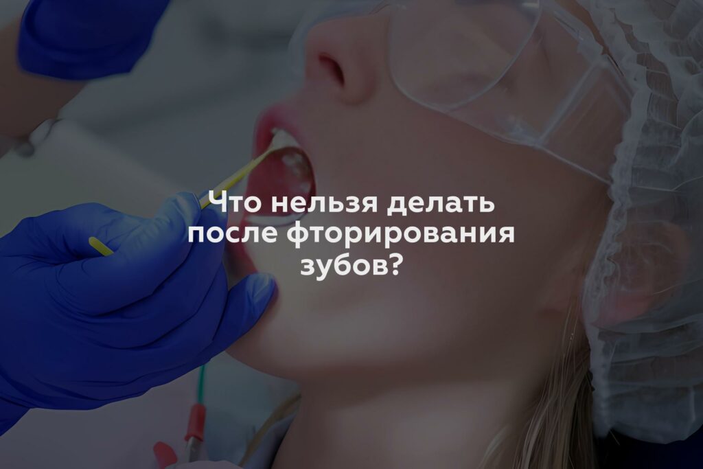 Что нельзя делать после фторирования зубов?