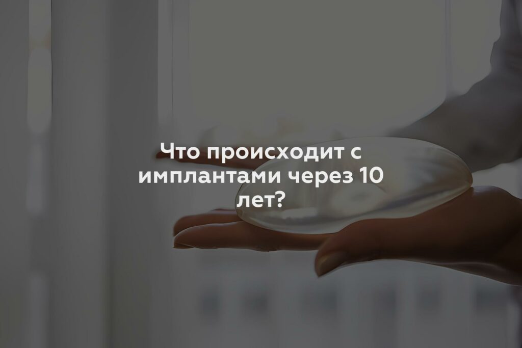 Что происходит с имплантами через 10 лет?