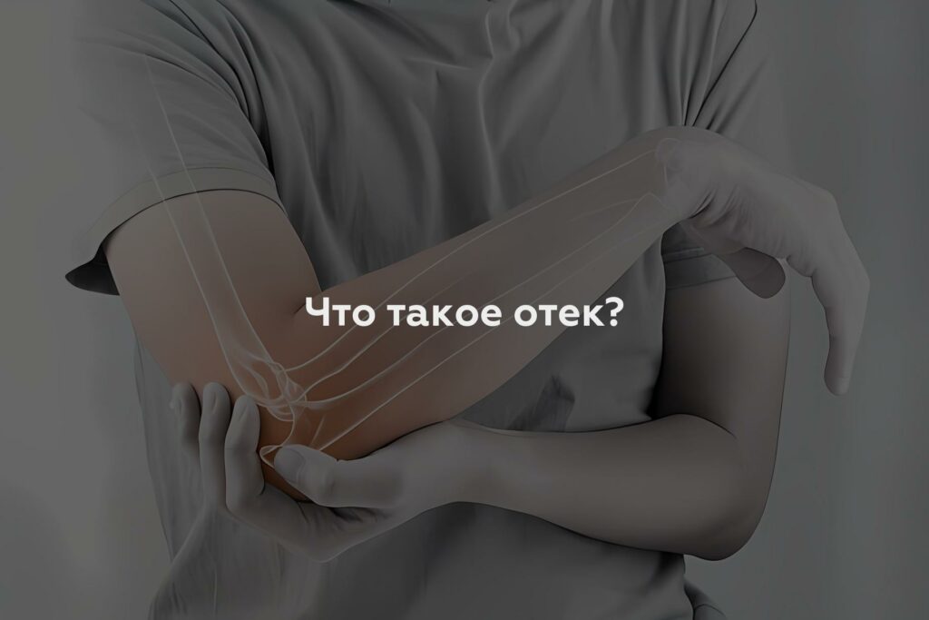 Что такое отек?