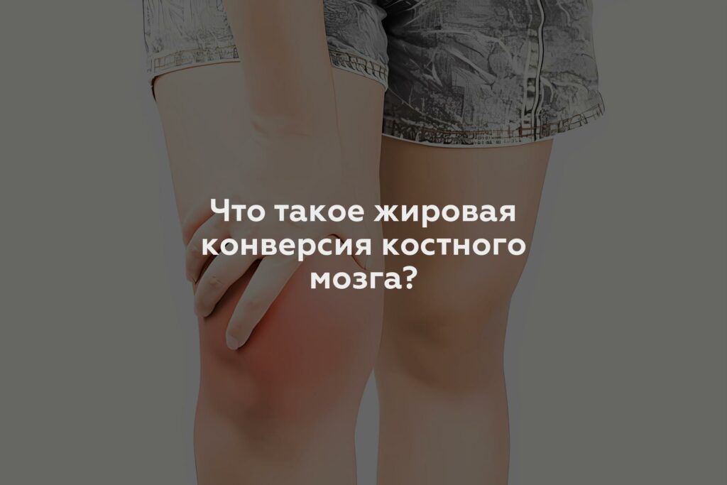 Что такое жировая конверсия костного мозга?