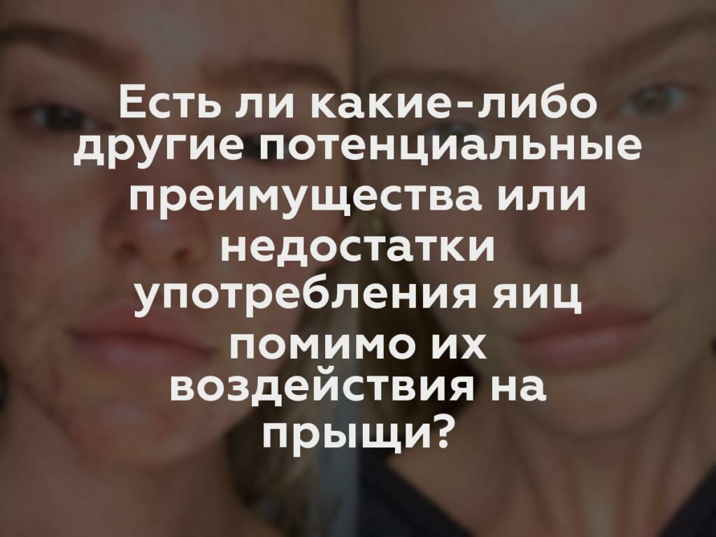 Есть ли какие-либо другие потенциальные преимущества или недостатки употребления яиц помимо их воздействия на прыщи?