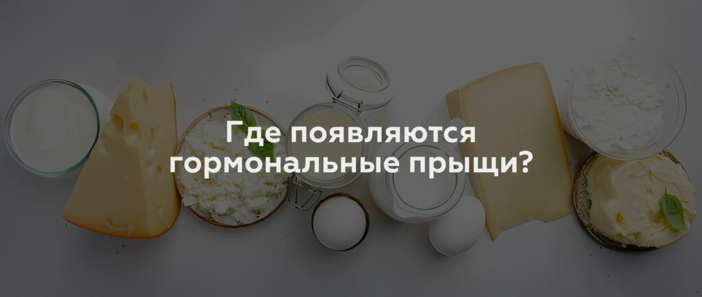 Где появляются гормональные прыщи?