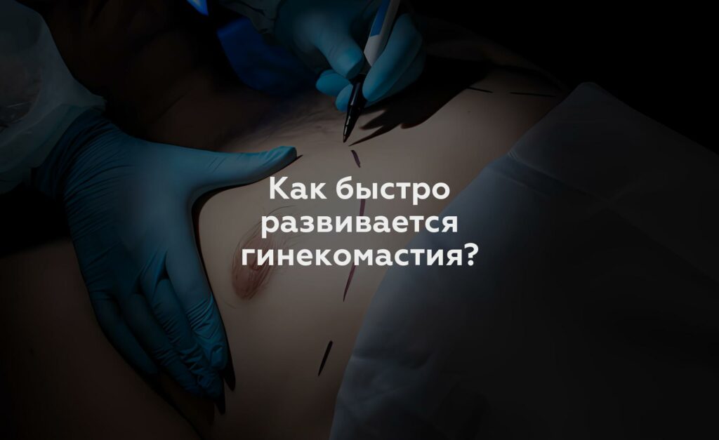 Как быстро развивается гинекомастия?