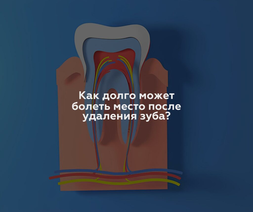 Как долго может болеть место после удаления зуба?