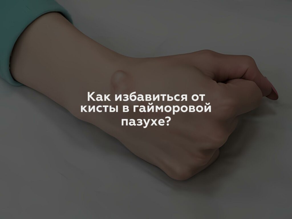 Как избавиться от кисты в гайморовой пазухе?