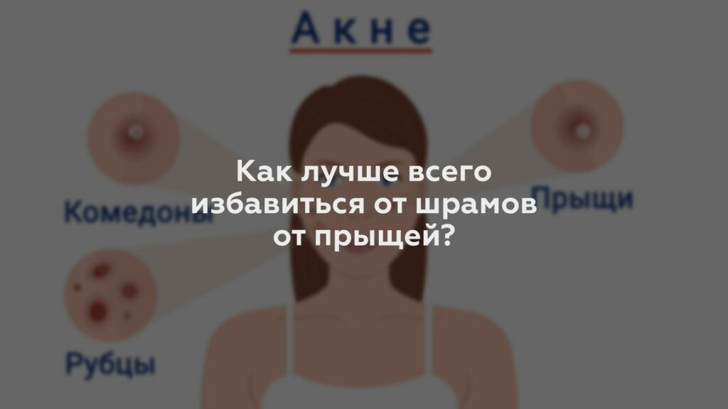 Как лучше всего избавиться от шрамов от прыщей?