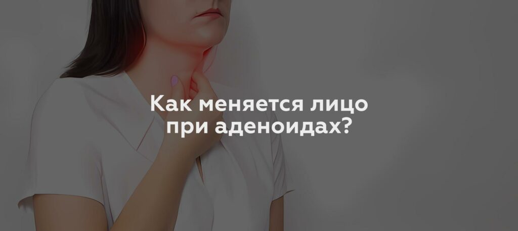 Как меняется лицо при аденоидах?