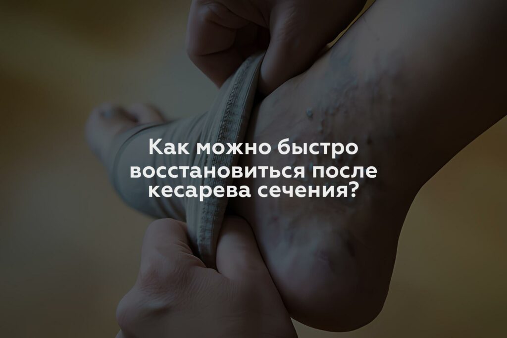 Как можно быстро восстановиться после кесарева сечения?