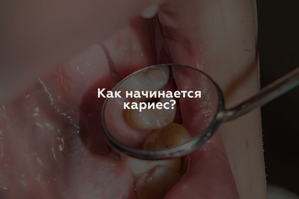 Как начинается кариес?