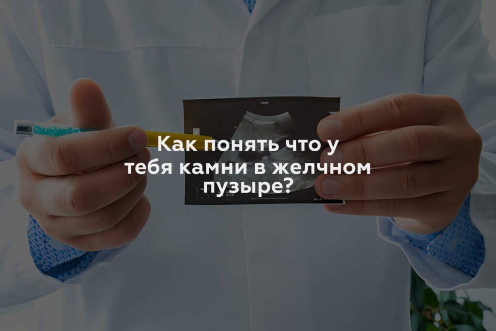 Как понять что у тебя камни в желчном пузыре?