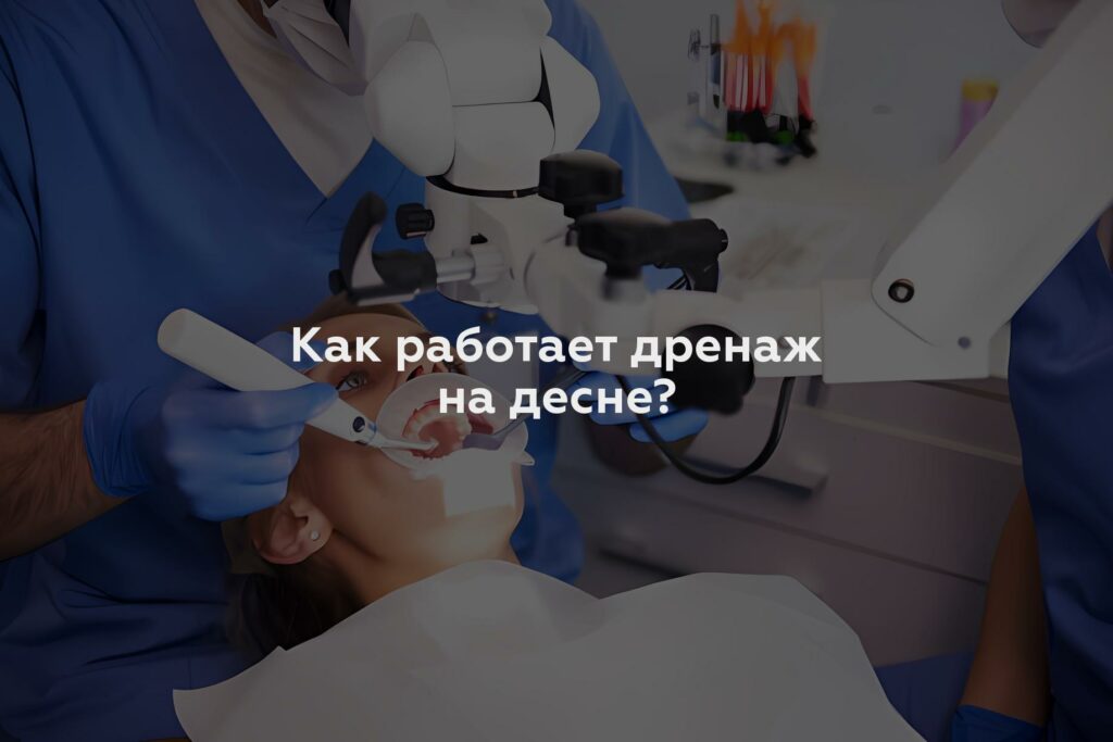 Как работает дренаж на десне?