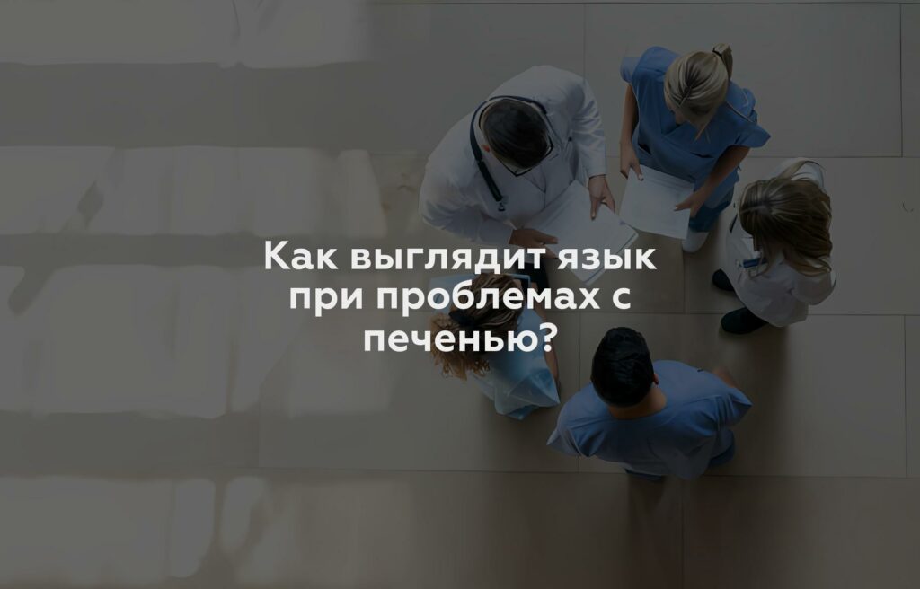 Как выглядит язык при проблемах с печенью?