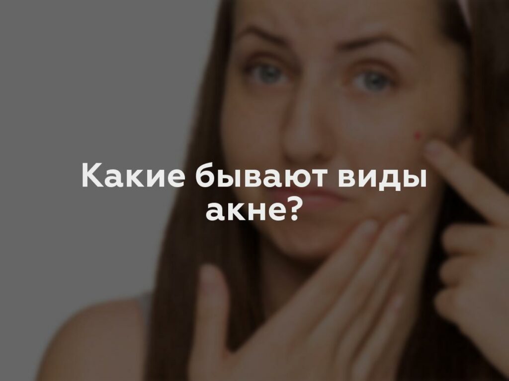 Какие бывают виды акне?