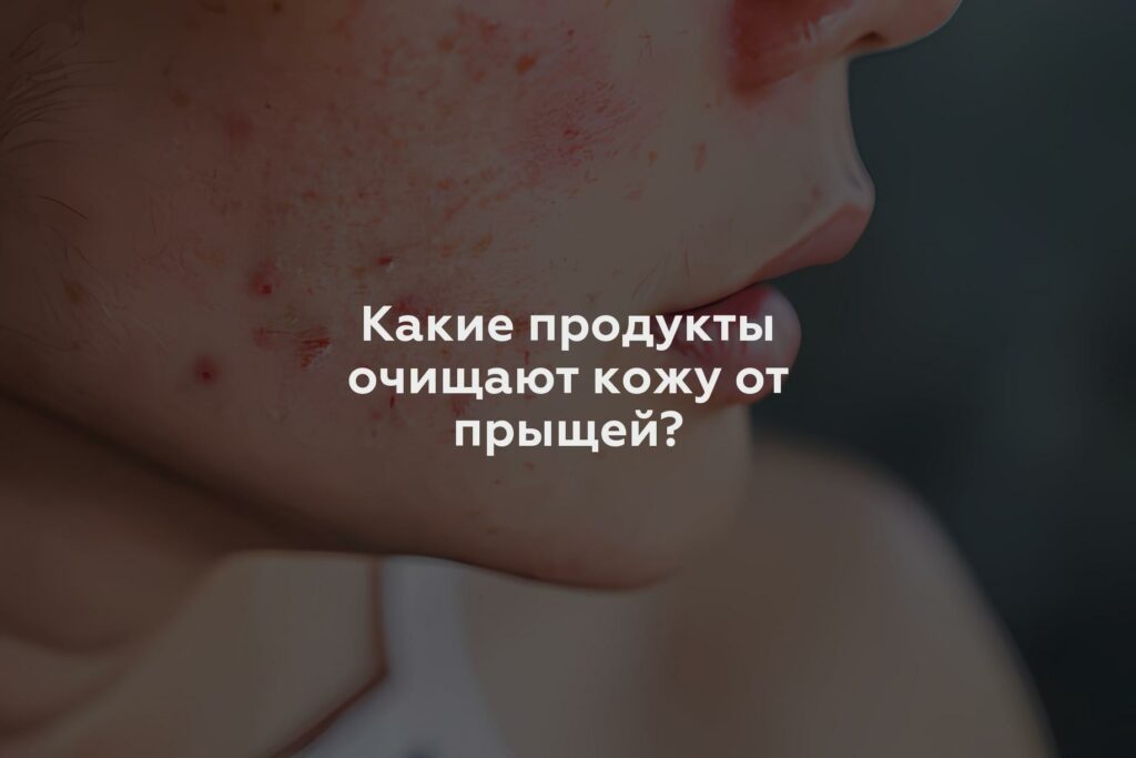 Какие продукты очищают кожу от прыщей?