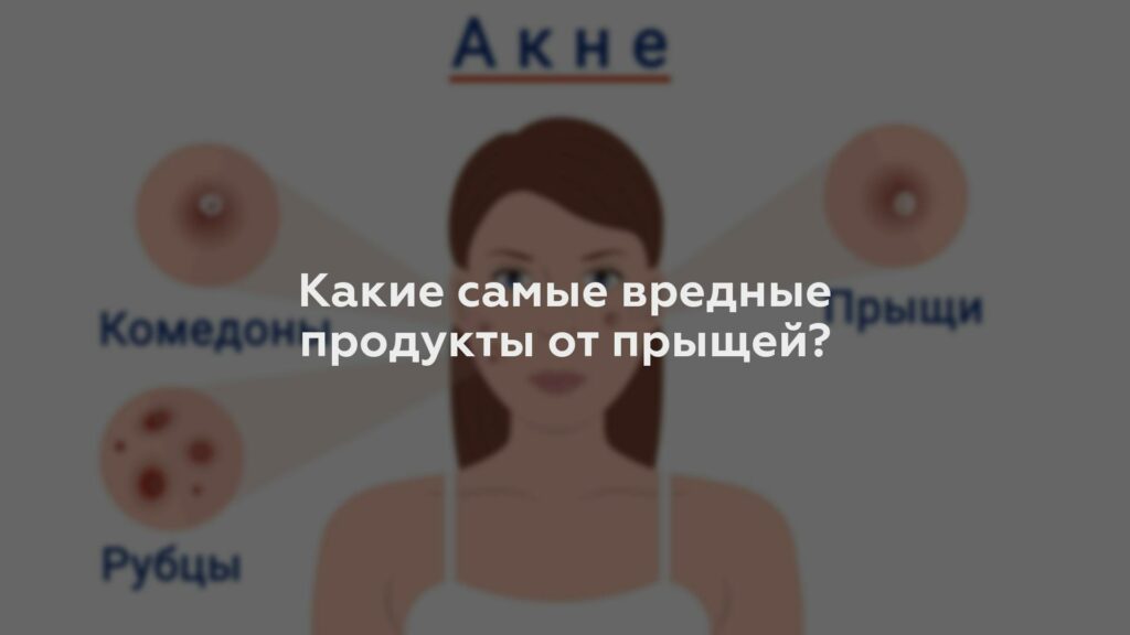 Какие самые вредные продукты от прыщей?