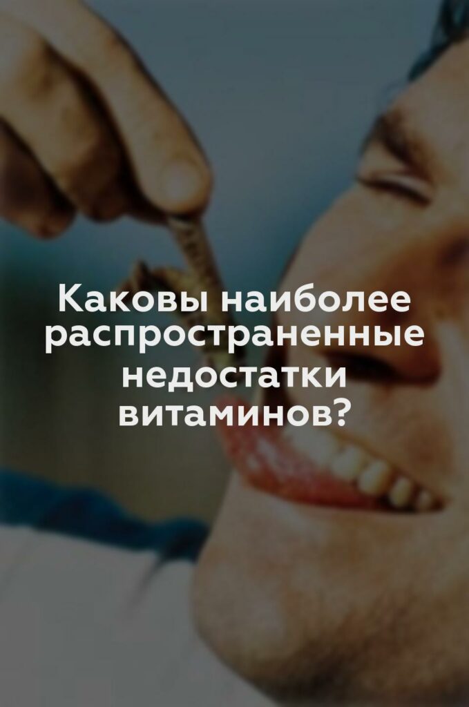 Каковы наиболее распространенные недостатки витаминов?