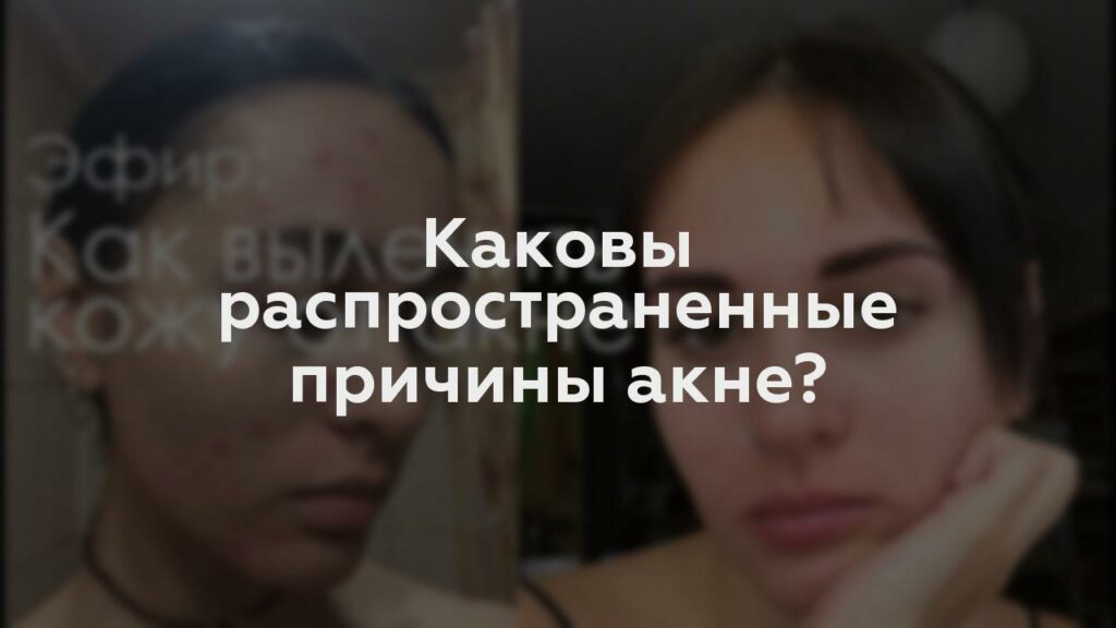 Каковы распространенные причины акне?