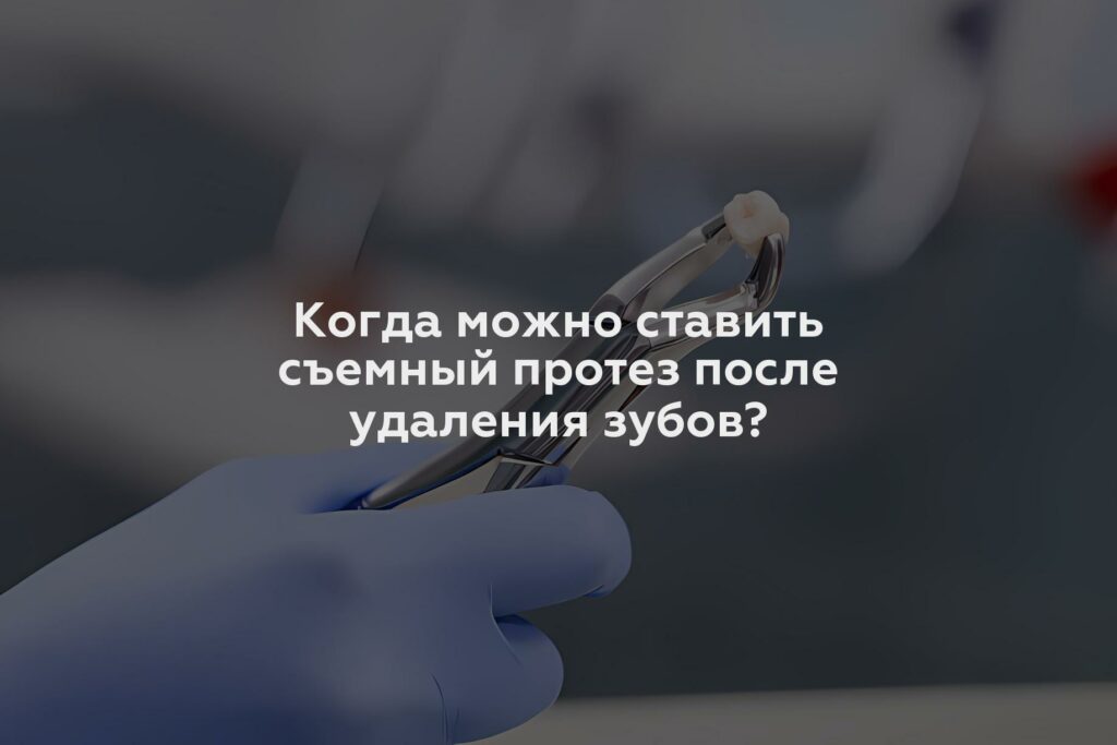 Когда можно ставить съемный протез после удаления зубов?