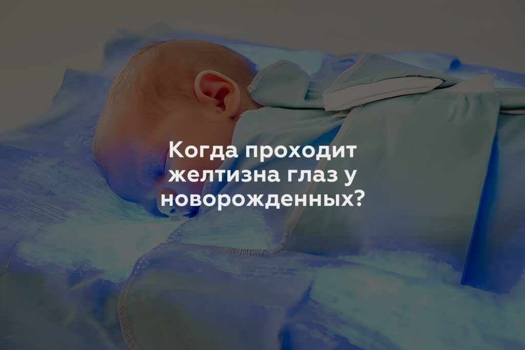 Когда проходит желтизна глаз у новорожденных?