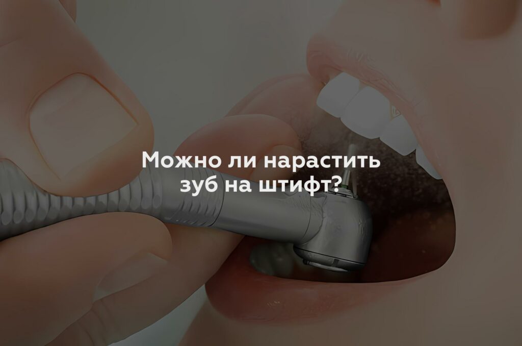 Можно ли нарастить зуб на штифт?