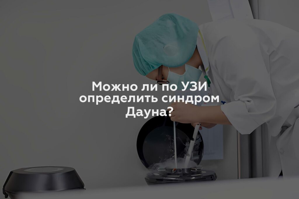 Можно ли по УЗИ определить синдром Дауна?