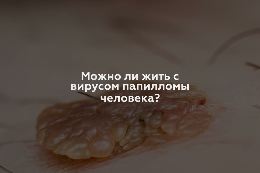 Можно ли жить с вирусом папилломы человека?