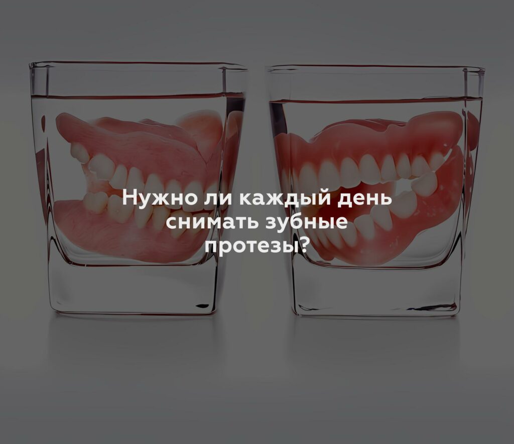 Нужно ли каждый день снимать зубные протезы?