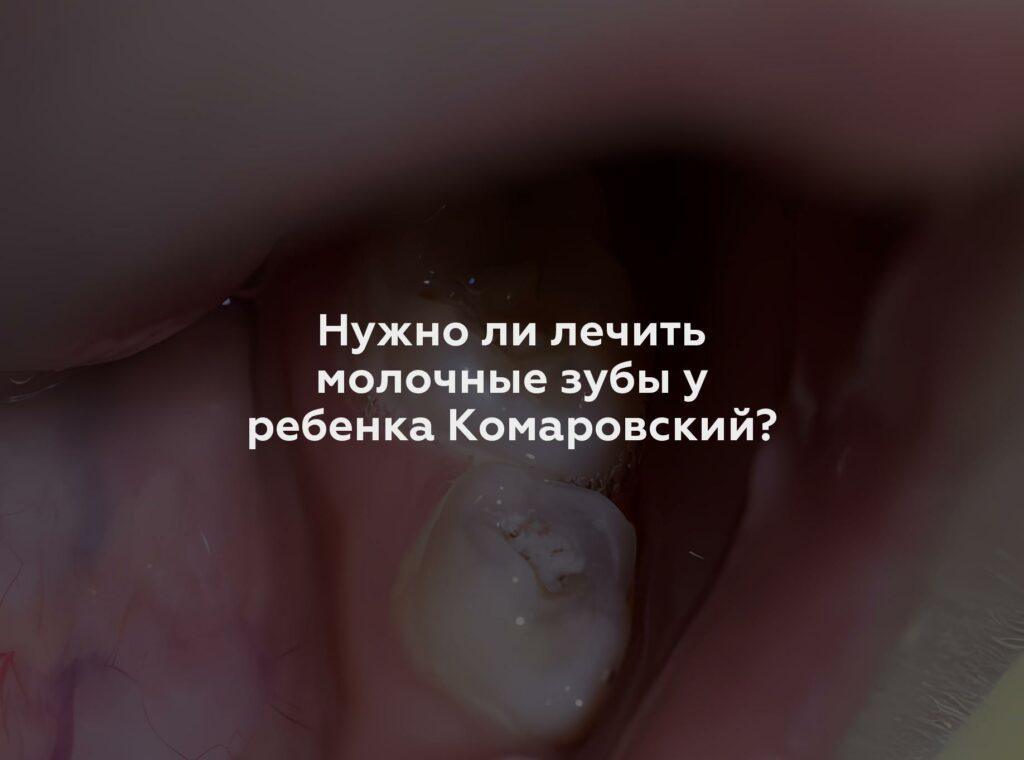 Нужно ли лечить молочные зубы у ребенка Комаровский?