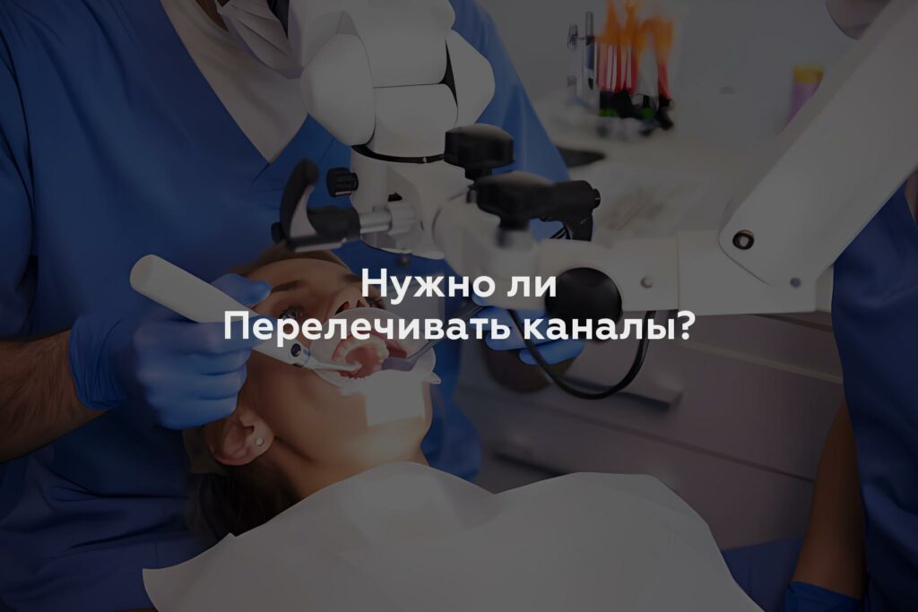 Нужно ли Перелечивать каналы?