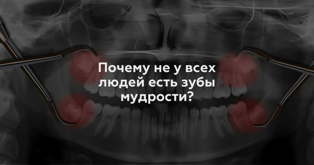 Почему не у всех людей есть зубы мудрости?