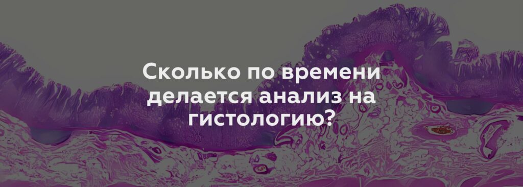 Сколько по времени делается анализ на гистологию?