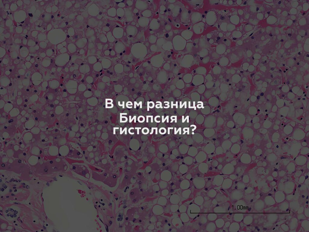 В чем разница Биопсия и гистология?