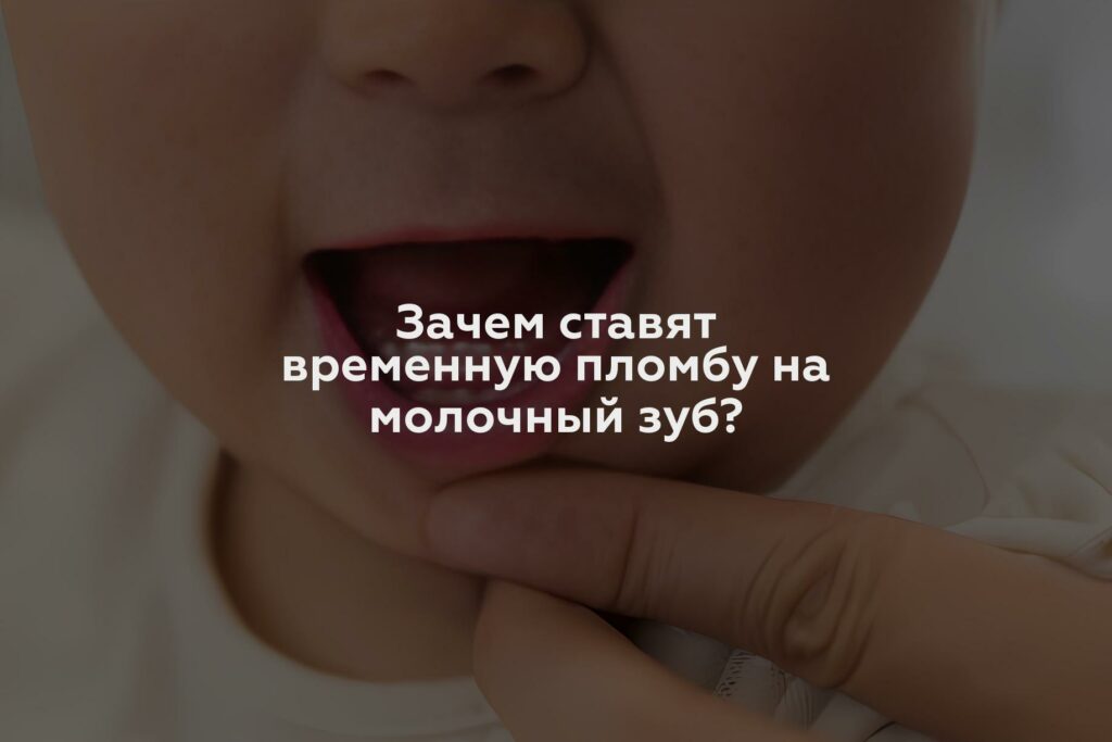 Зачем ставят временную пломбу на молочный зуб?